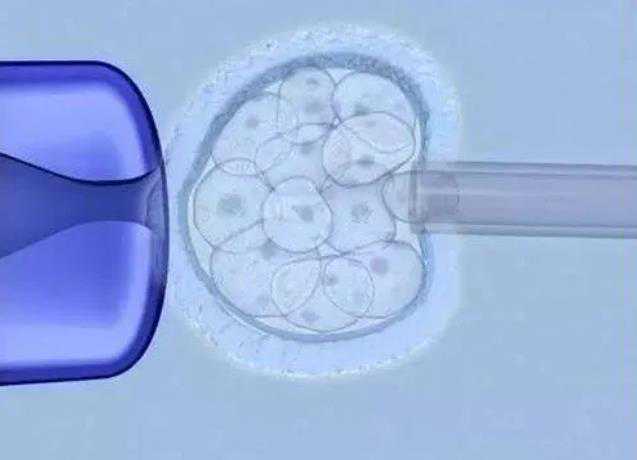 金华供卵试管中心 金华人民医院做试管婴儿的成功率多少? ‘b超角度看男女’