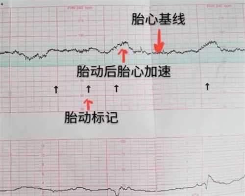 重庆哪里有正规专业供卵机构 重庆的私立试管婴儿医院可靠吗? ‘nt看男女加微