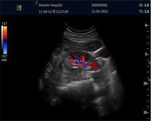 重庆助孕在哪找 2024重庆试管婴儿包生男孩医院排名 ‘b超单xy看男女准吗’