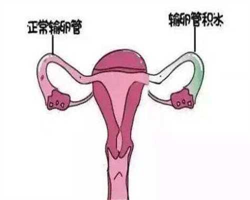 重庆高龄借卵生子流程 重庆四维彩超预约流程 ‘nt单月亮型看男女’