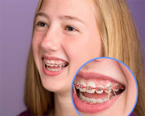 借卵助孕找重庆世纪 重庆妇幼保健院哪家好？试管技术好不好 ‘四维彩超五官